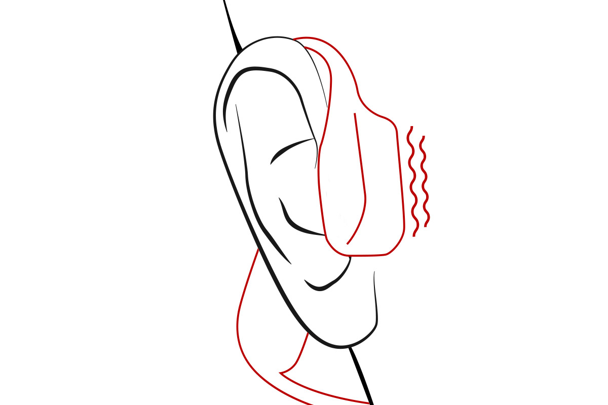 Schéma conduction osseuse