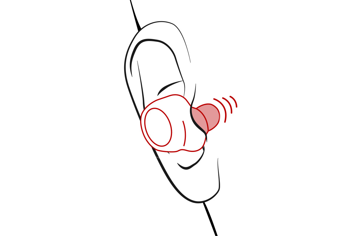 Schema Positionnement des Ecouteurs intras 